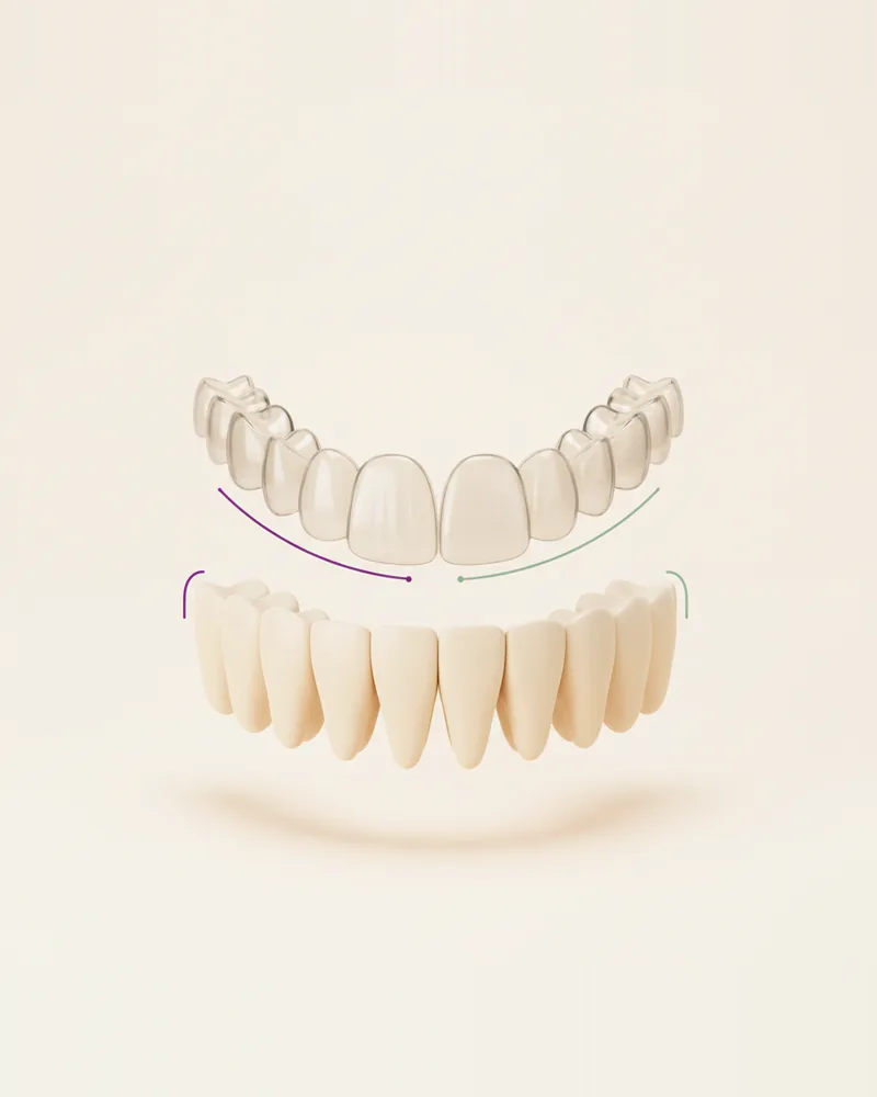 Alineación Invisible en Querétaro, TAND Clínica Dental