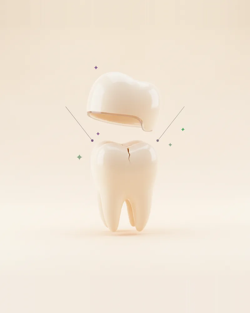 Coronas y Puentes en Querétaro, TAND Clínica Dental