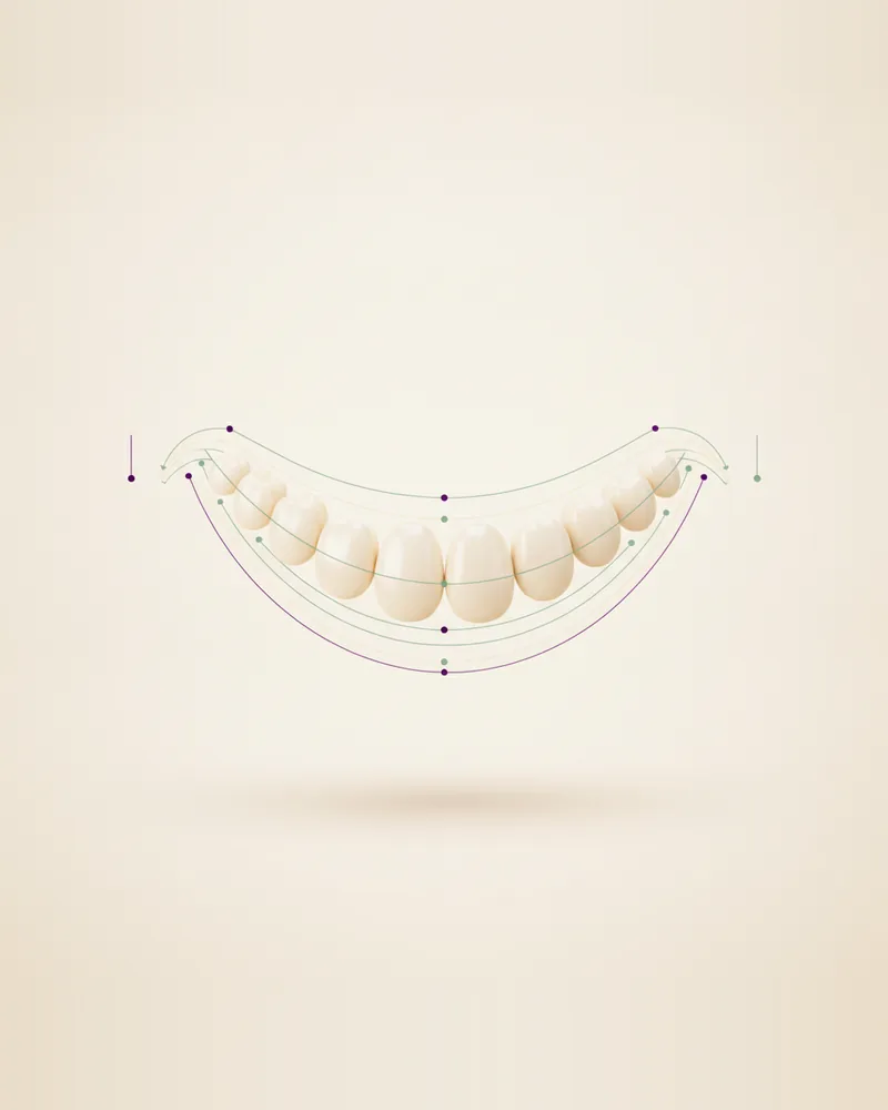 Diseño de Sonrisa en Querétaro, TAND Clínica Dental