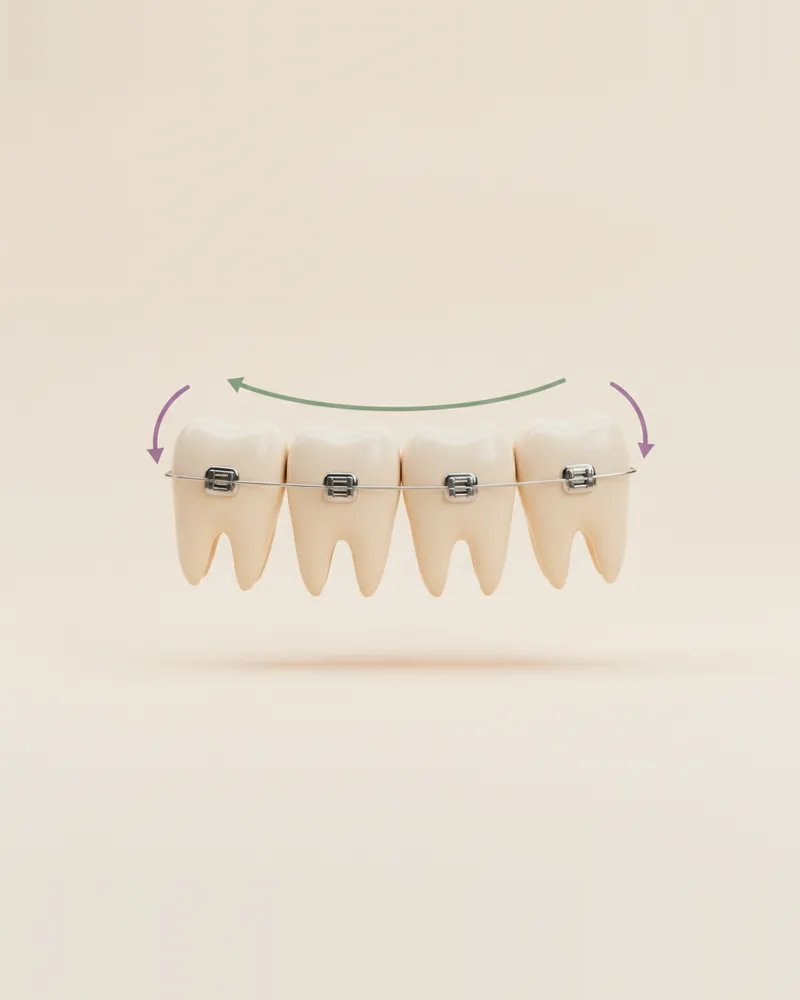 Ortodoncia Tradicional en Querétaro, TAND Clínica Dental