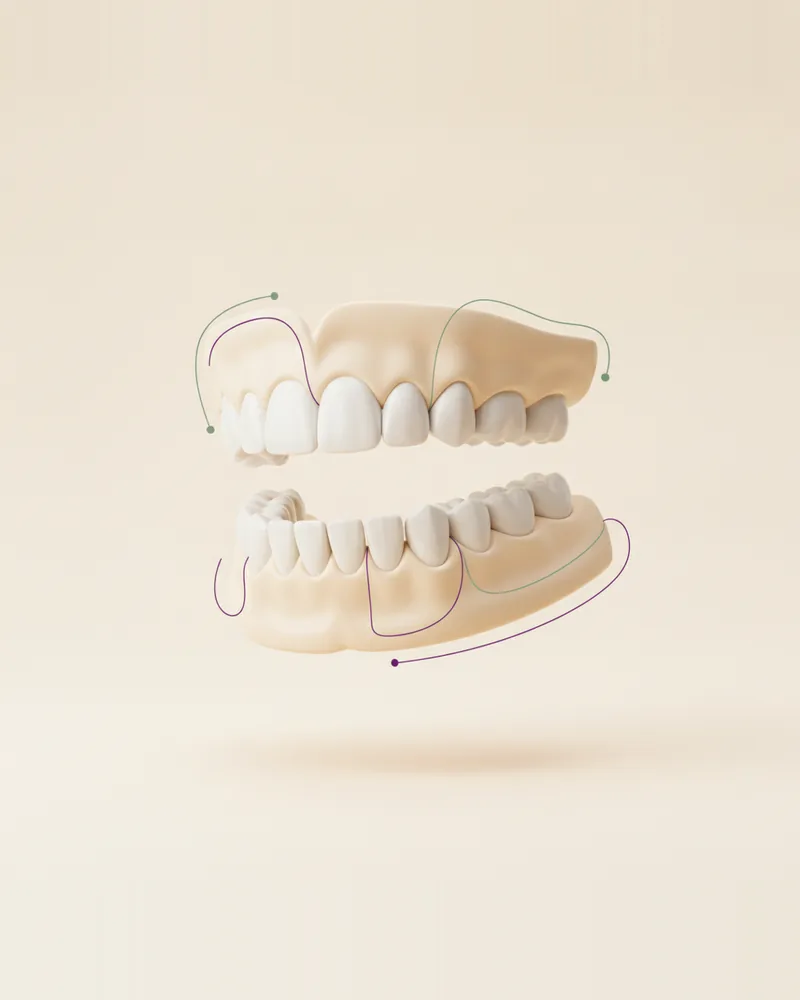 Prótesis Dental en Querétaro, TAND Clínica Dental