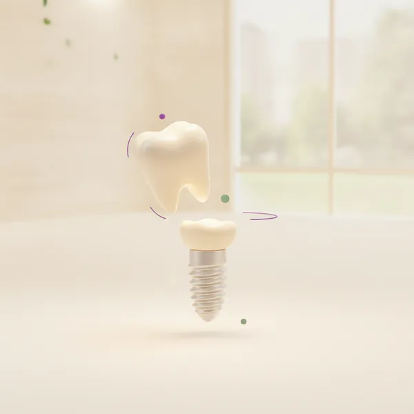 Guía de Implantes Dentales de TAND Clínica Dental
