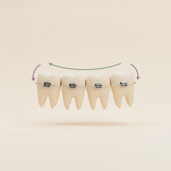 Ortodoncia en TAND Clínica Dental, Querétaro