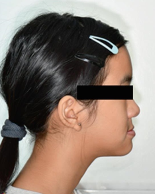 Fotografía extraoral de perfil